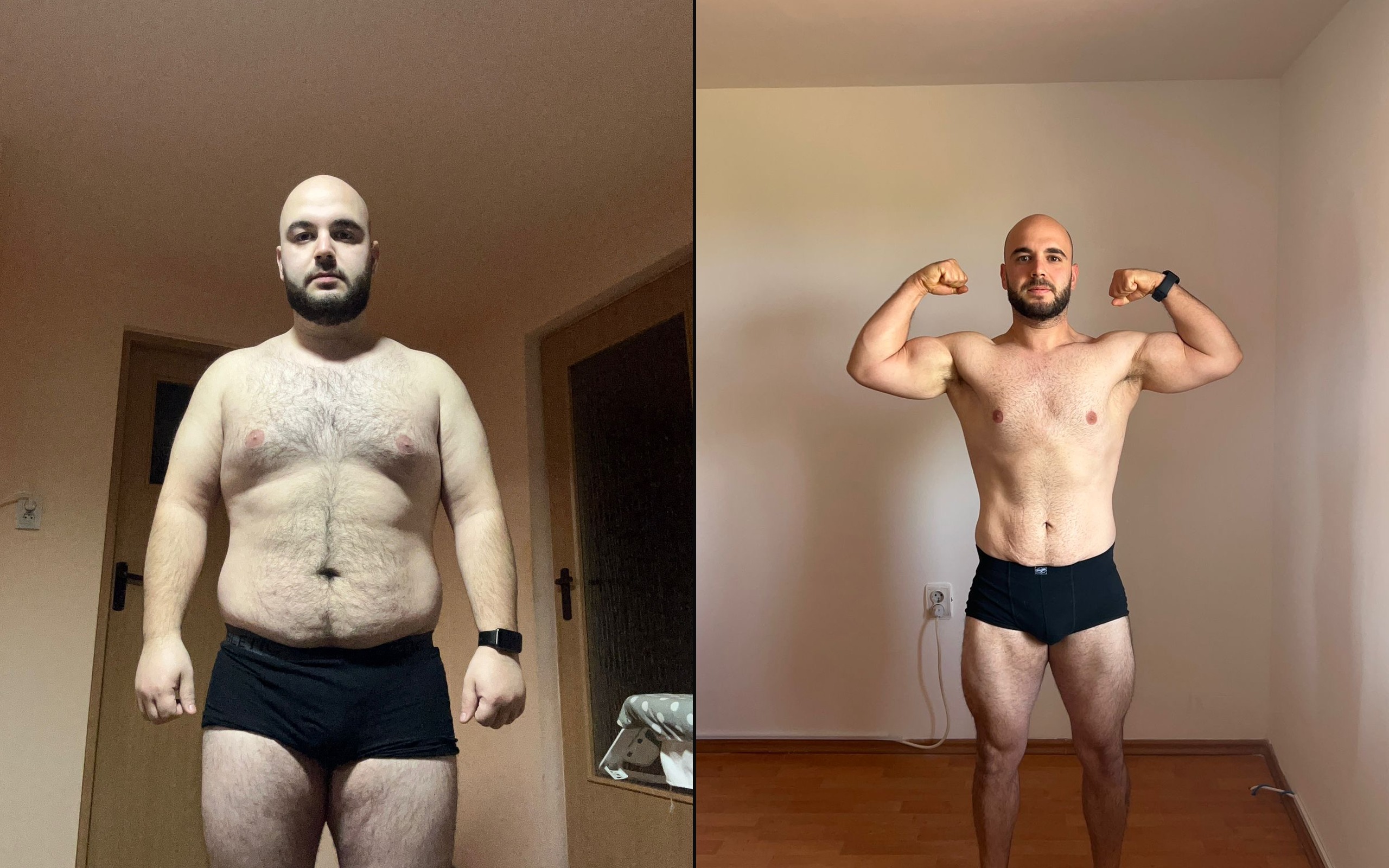 Radu — transformare before/after